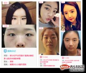 整容失败案例图片,整容失败案例警示录